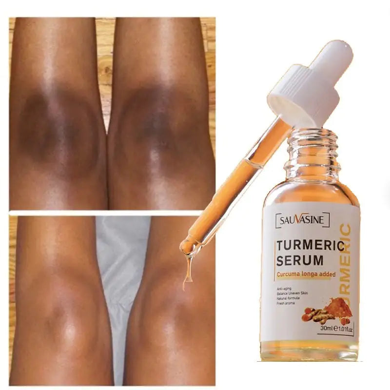 Natural Glow Serum: Turmeric Infused Skincare Solution